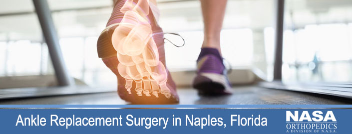 Ankle Replacement in Naples, Florida | NASA MRI Blog