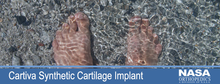 Cartiva Synthetic Cartilage Implant | NASA MRI Blog